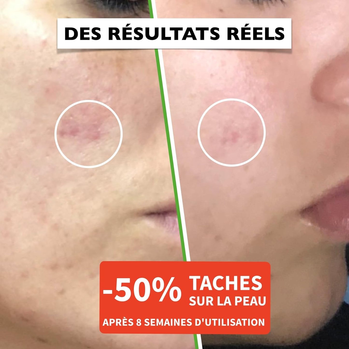 60 ml Bio Sérum Visage à la Vitamine C, Acide Hyaluronique Pur, Vit. E, B5 et Niacinamide. Anti-Rides, Anti-Taches, Anti-âge et Hydratant. Soin Visage Vegan & Cruelty Free.Testé Dermatologiquement