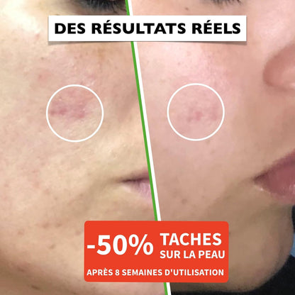 60 ml Bio Sérum Visage à la Vitamine C, Acide Hyaluronique Pur, Vit. E, B5 et Niacinamide. Anti-Rides, Anti-Taches, Anti-âge et Hydratant. Soin Visage Vegan & Cruelty Free.Testé Dermatologiquement